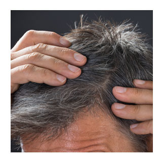 Man showing grey hair at the temples